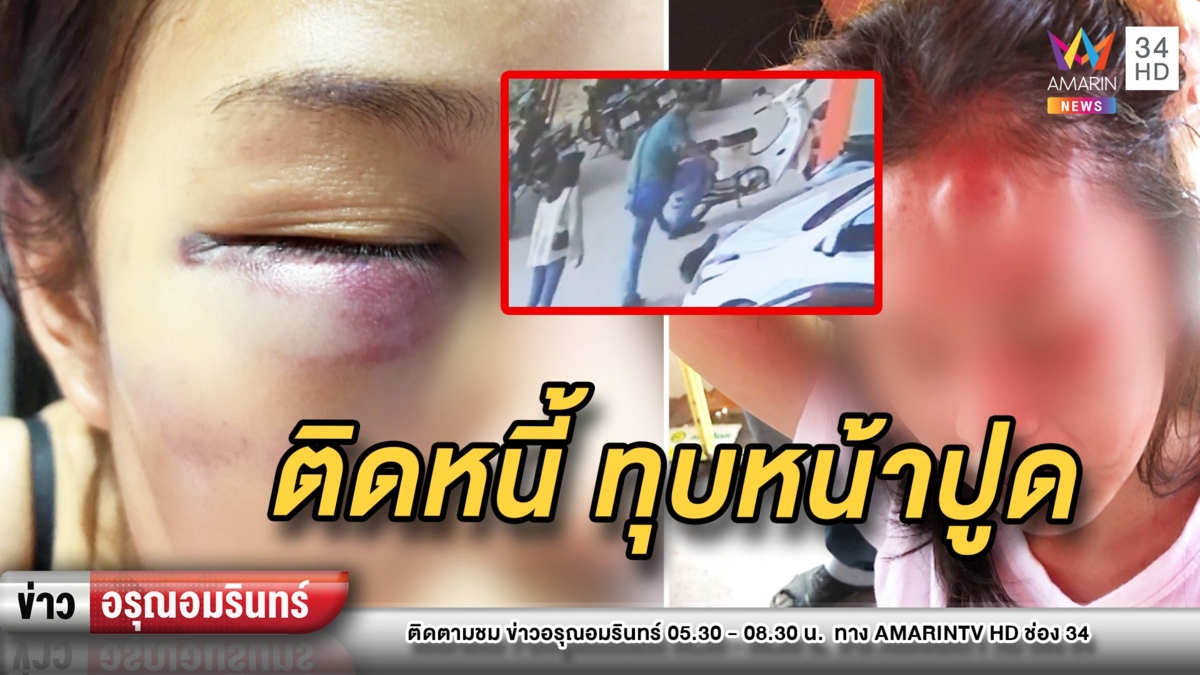 เดือด! นายทุนเงินกู้โหดจิกหัวลากพีอาร์สาว ปืนทุบหน้าปูด-ตาช้ำ