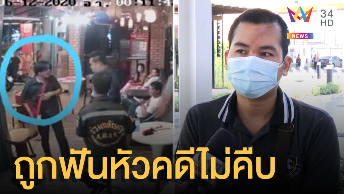 หนุ่มร้อง ถูกฟันหัวกะโหลกยุบ เหตุมองหน้าในผับ ผ่านมา 1 เดือน คดีไม่คืบ