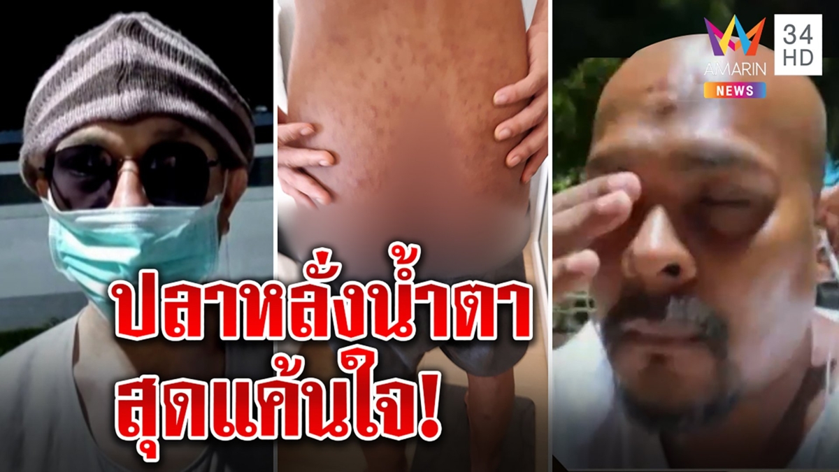 หมอปลาหลั่งน้ำตาแค้นแก๊งตร.จับคนส่งศูนย์บำบัดแลกหัวคิว เหยื่อถูกฟาดตูดเน่า