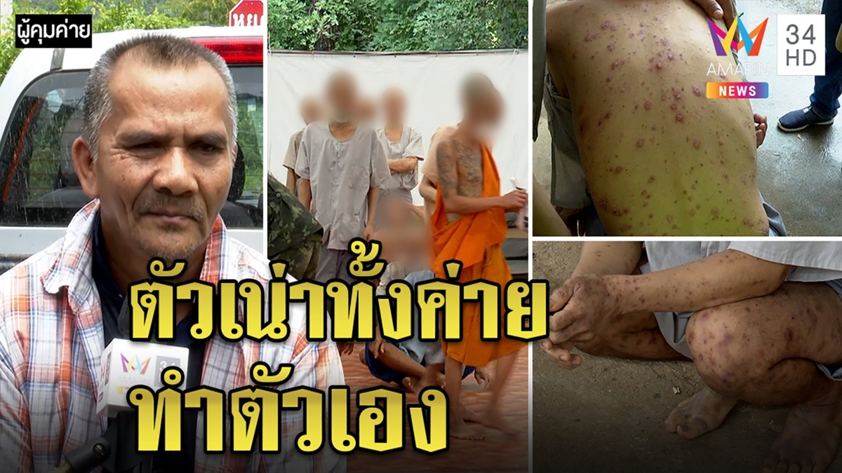 ผู้คุมค่ายบำบัดยาโบ้ยพระตีคนป่วยอ้างดื้อไม่ทายาจนตัวเน่า โอดสูญเงิน