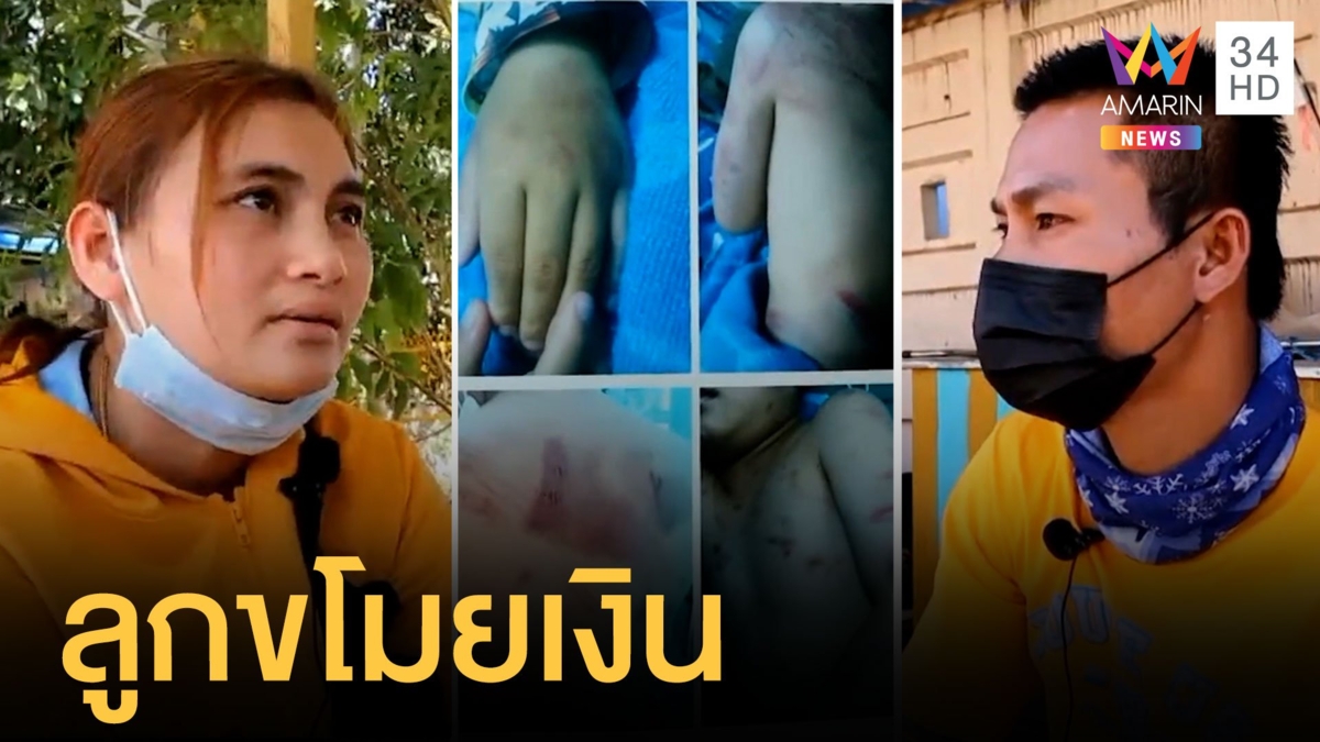 เด็ก 7 ขวบบอกพ่อเลี้ยงทำร้ายน่วมทั้งตัว แม่เด็กบอกเป็นคนตีเอง