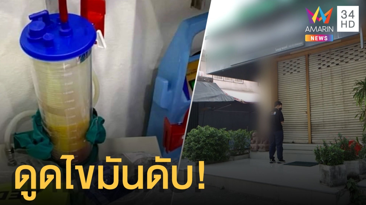 ดูดไขมันดับ! น้องสาวอดีตรองผู้ว่าเสียชีวิตหลังดูดไขมัน
