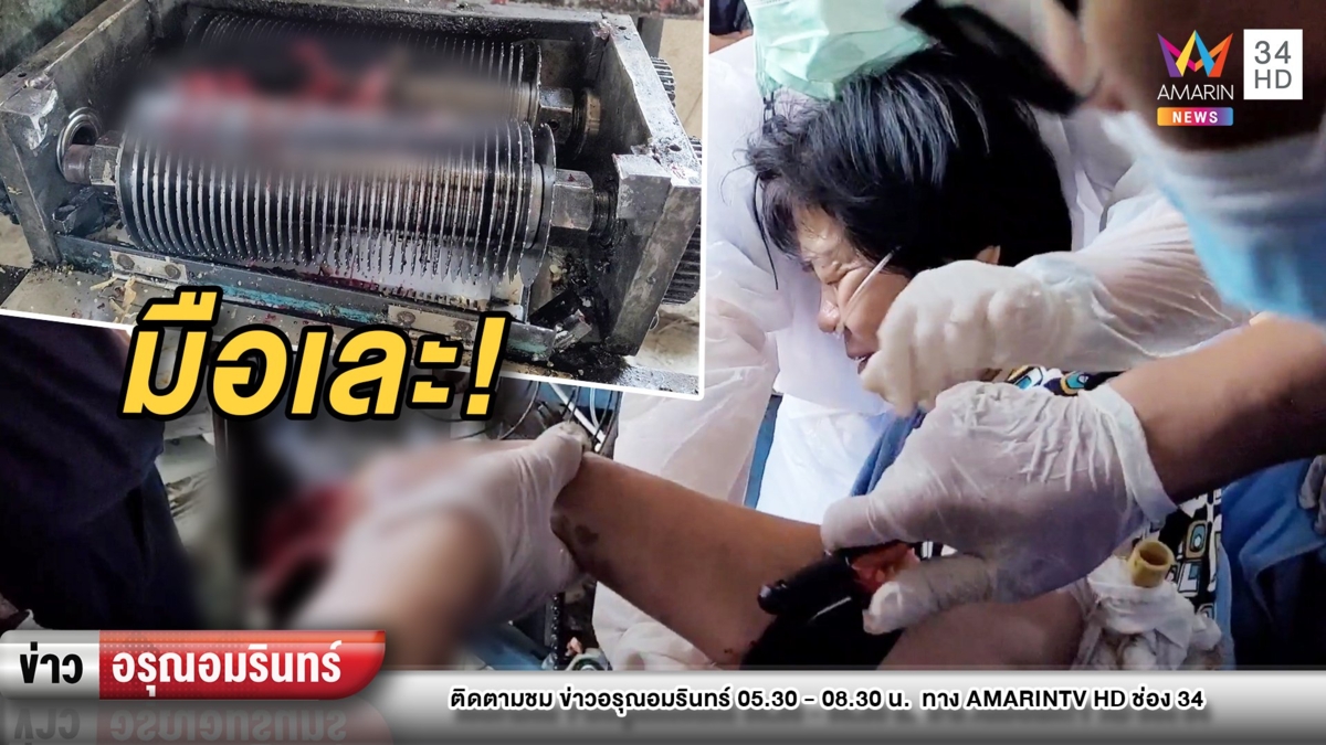 เจ้าของโรงงานแคปหมู พลาดมือติดเครื่องหั่นเละ เลือดนอง