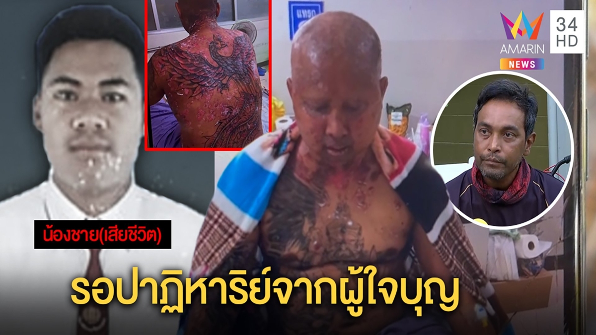 หนุ่มป่วยตุ่มน้ำพองไร้เงินรักษาซ้ำน้องชิงฆ่าตัวตาย "วินัย"เชื่อปาฏิหาริย์มีจริง