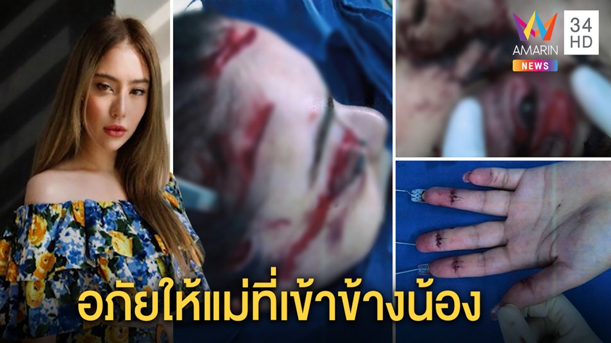 เปิดใจ"มีล่า"ถูกน้องแทงหวิดตาย อภัยให้แม่สั่งปิดข่าวเผยผวาทุกคืนจนต้องบำบัด