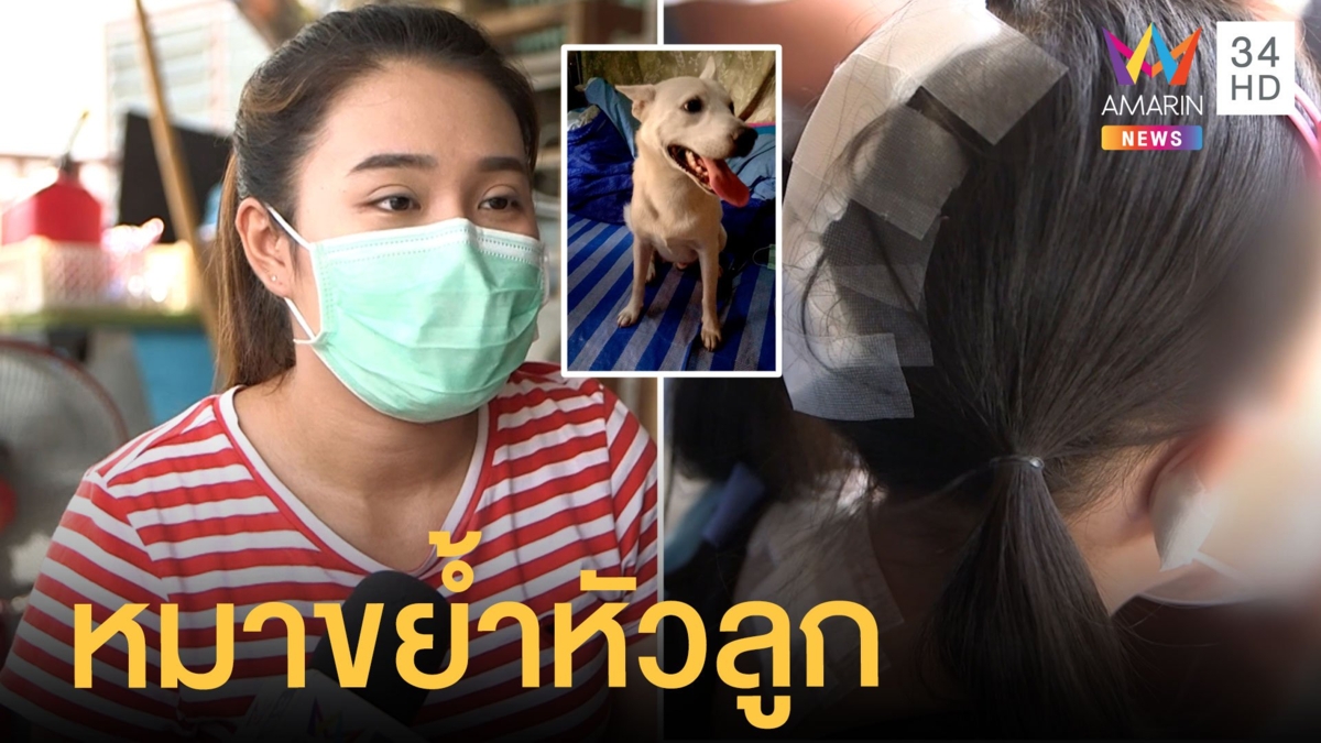 สาวร้องเพื่อนบ้านปล่อยหมากัดลูกหัวเหวอะ