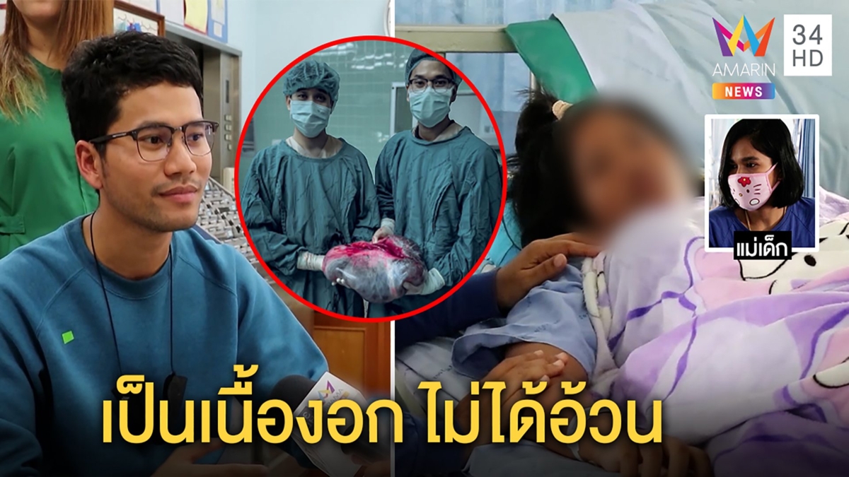 อย่าคิดว่าอ้วน!เปิดใจหมอผ่าท้องเด็ก12เจอเนื้องอกรังไข่ก้อนยักษ์แม่ขอบคุณช่วยทัน