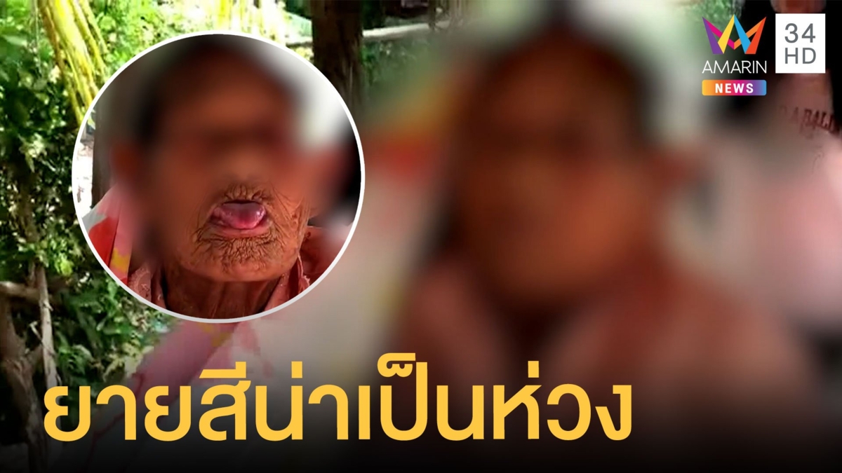 สธ.เข้าเยี่ยม 'ปอบยายสี' ยังพูดจาวกวน ไม่ยอมไปรพ.อาการน่าเป็นห่วง