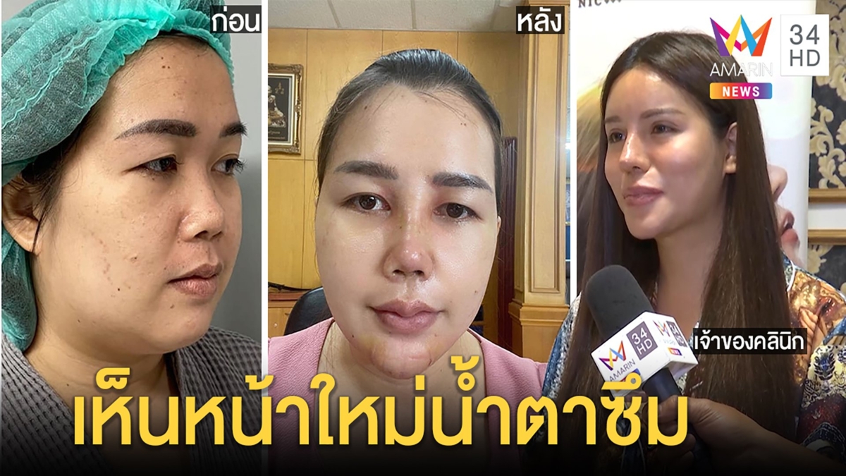 คลินิกใจป้ำทุ่มครึ่งล้านเปลี่ยนลุคเมียหลวงยืนหนึ่ง เจ้าตัวตะลึงโฉมใหม่ไม่ง้อผัว