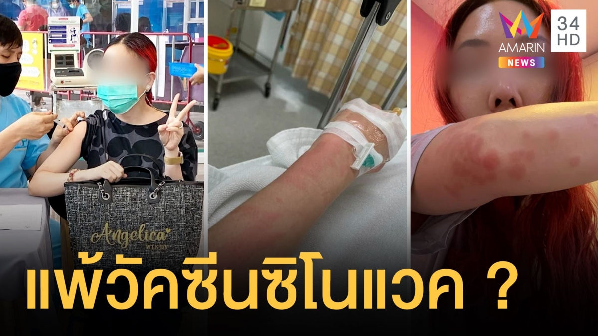 กัปตันสาวรีวิวฉีดวัคซีนซิโนแวค อาการแพ้ผื่นแดงแน่นหน้าอก