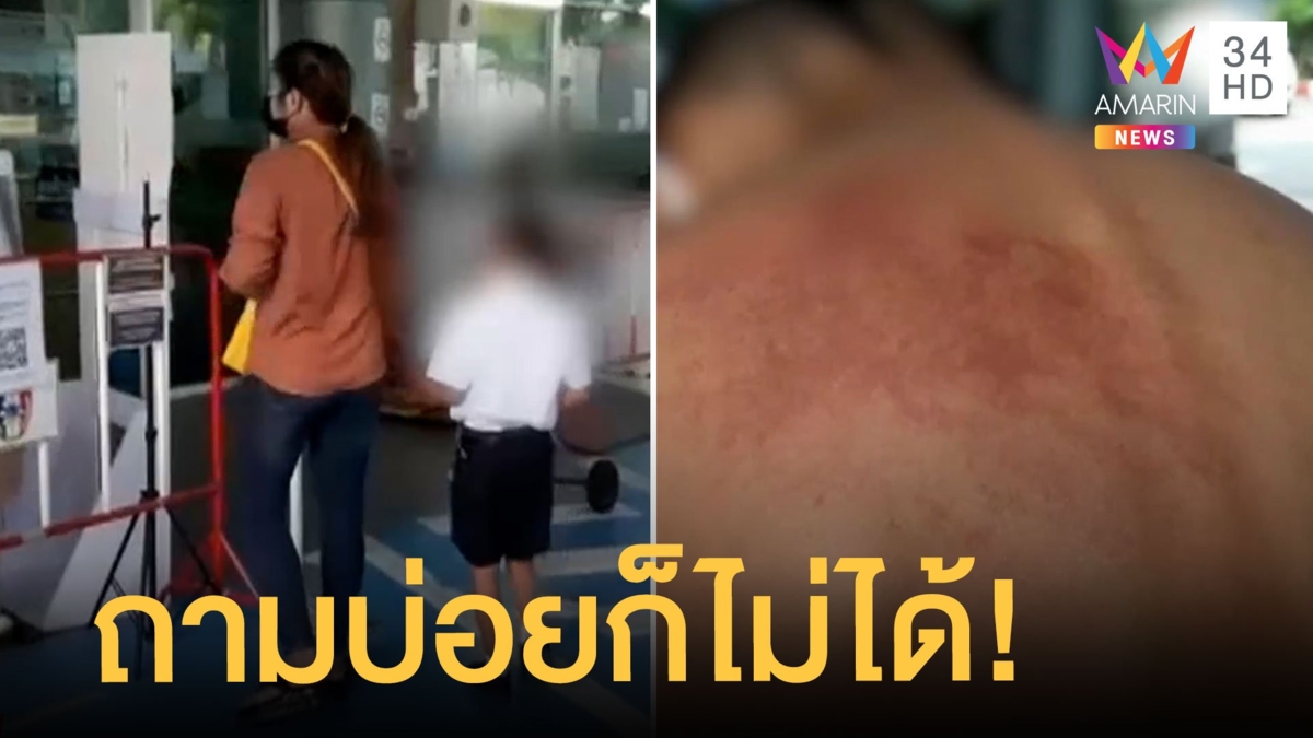 แม่แจ้งจับครูตีลูก 'หลังระบม' ฉุนถามบ่อย