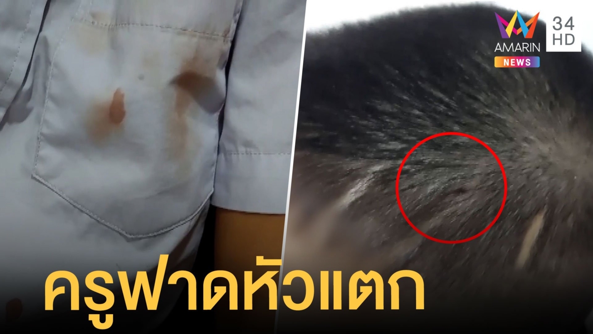 แม่รับไม่ได้ ครูใช้แปรงลบกระดานฟาดหัว นร. 10 ขวบ เลือดอาบ โร่แจ้ง ตร.