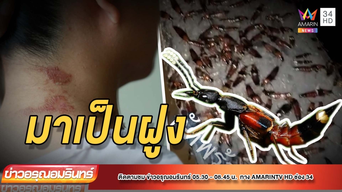 หนุ่มช็อก! เจอ “แมลงก้นกระดก” ยกฝูง