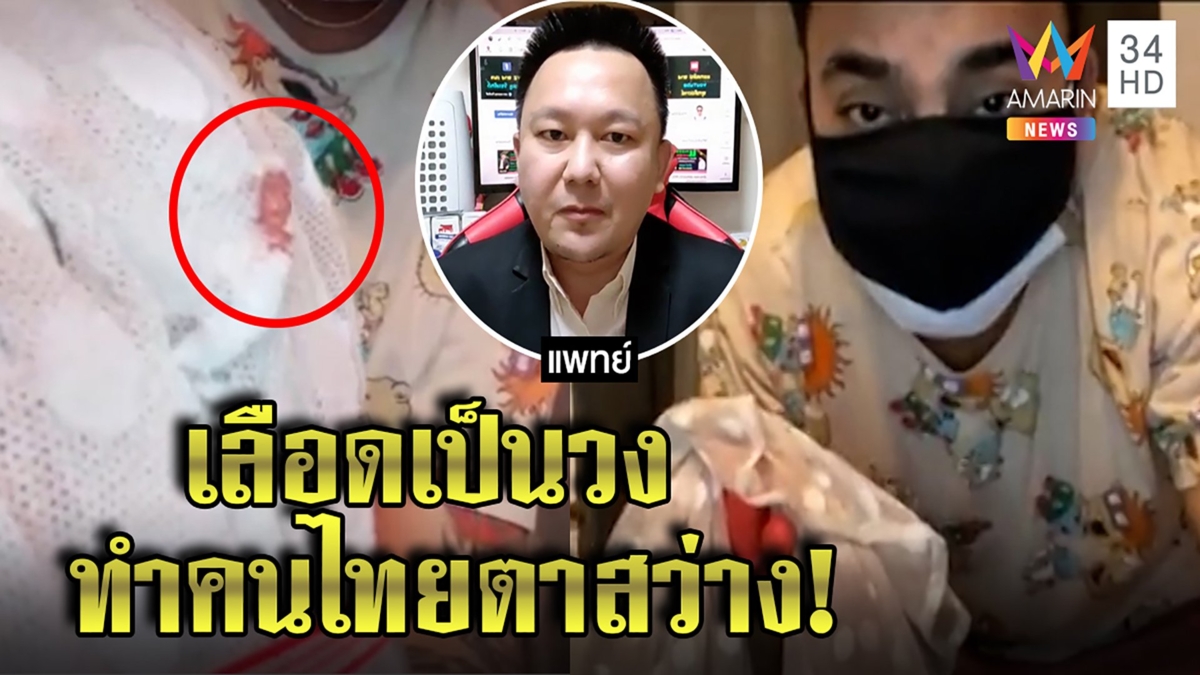 หมอตีแสกหน้าบังแจ็ค รู้แล้วใช่ผ้าแตงโมหรือไม่ ถอดรหัสเลือดเป็นวง ทำตาสว่าง