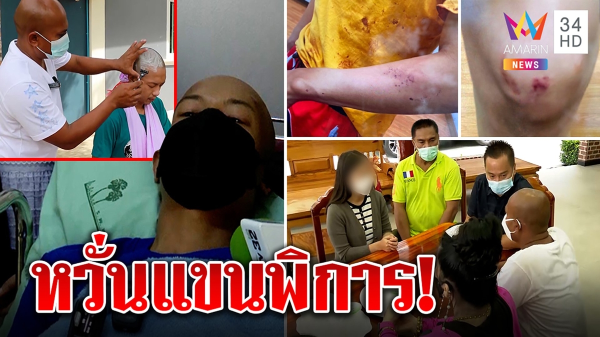 นายกเมืองเพชรฯ ป้อง "บาส" ลั่นใครล้างแค้นเจอดี เจ้าตัวหวั่นเสียแขนกระดูกแตก