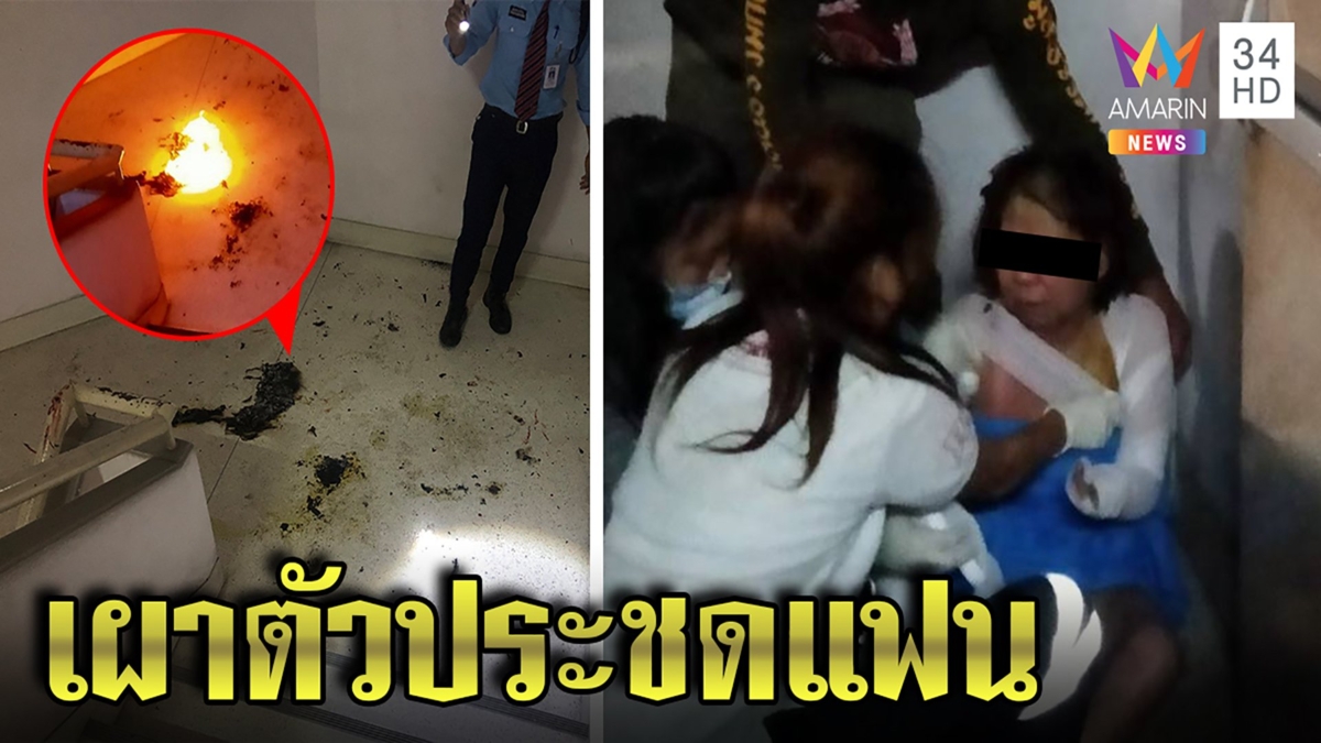 สาวน้อยใจแฟนญี่ปุ่น ฉีดสเปรย์แอลกอฮอล์-จุดไฟเผาตัว ก่อนวิ่งทุรนขอคนช่วย