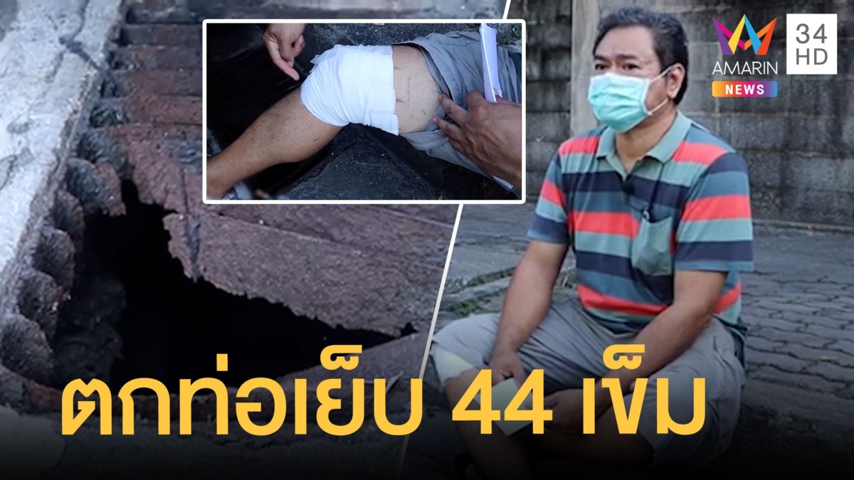 ฝาท่อพัง ลุงเดินตกเย็บ 44 เข็ม ขอหน่วยงานรัฐรับผิดชอบ