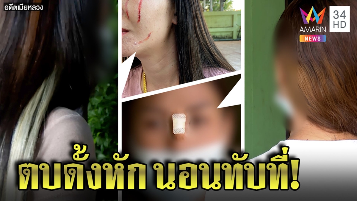 อดีตเมียหลวงตบสาวดั้งหัก แฉยับผัวพาสาวนอนเตียง หยามถ่ายรูปอวด "เค้าชอบฉัน"
