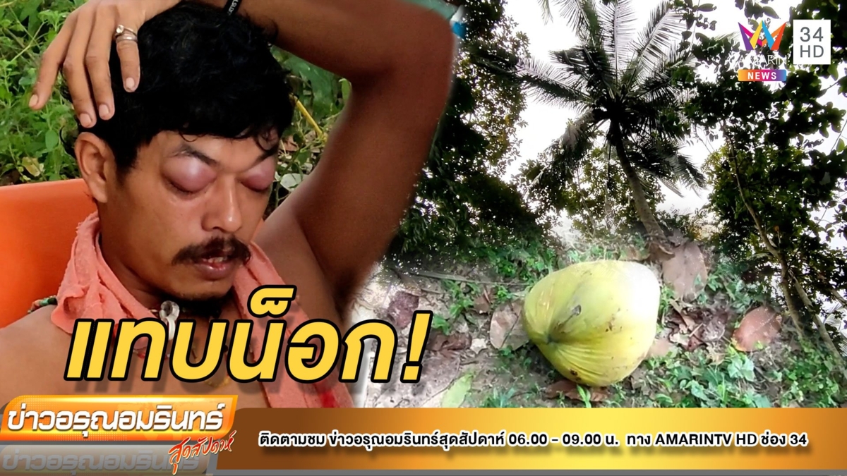 หนุ่มสอยมะพร้าวพลาด ตกใส่หัว กระอักเลือด ตาปูด