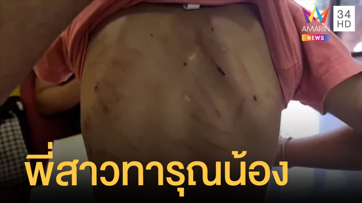 บุกช่วยเด็ก 6 ขวบ ถูกพี่สาวทำร้ายแผลเต็มตัว