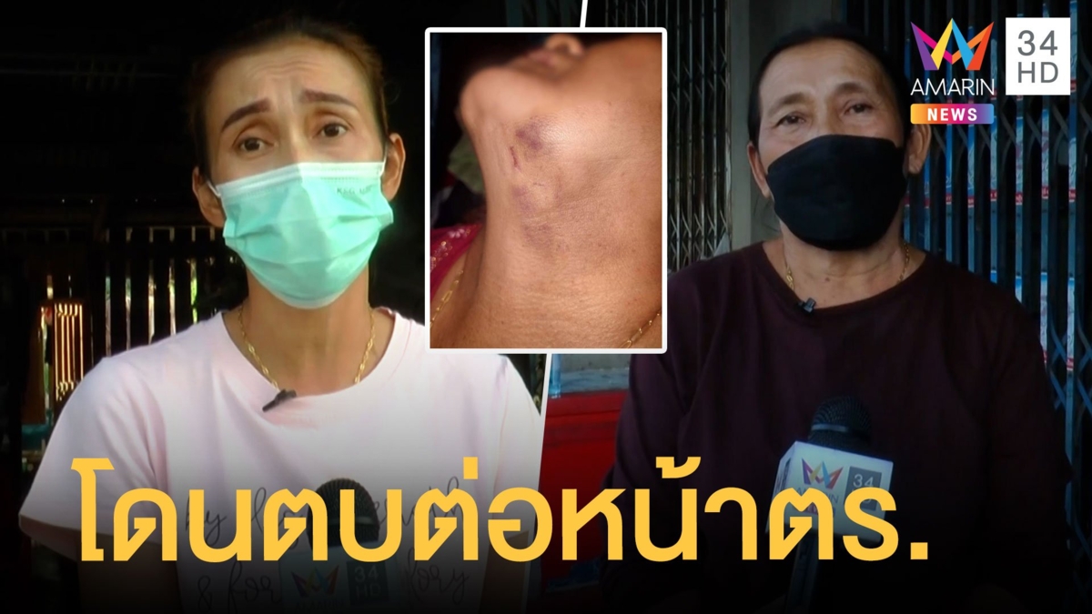 ลูกโวย แม่โดนตบต่อหน้าตร. สุดท้ายคดีไม่คืบ