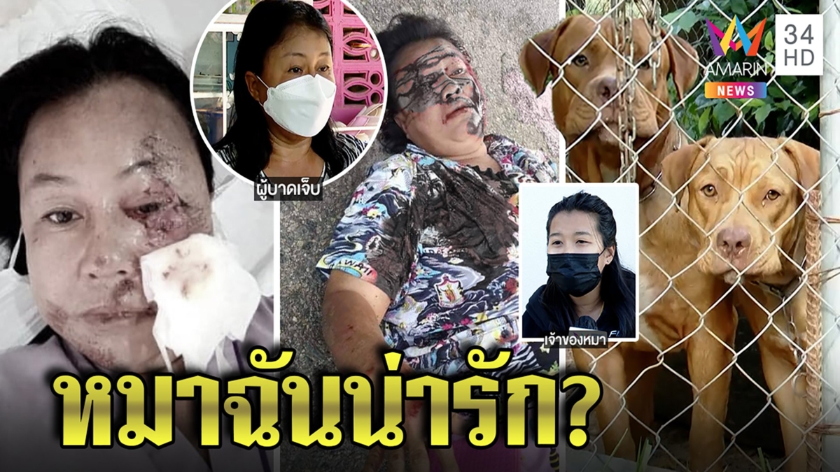พิตบูลขย้ำสาวหวิดตาบอด โวยค่าหมอเฉียดแสนไร้ช่วย เจ้าของหมาฉะอย่าโยนผิดขอหลักฐาน