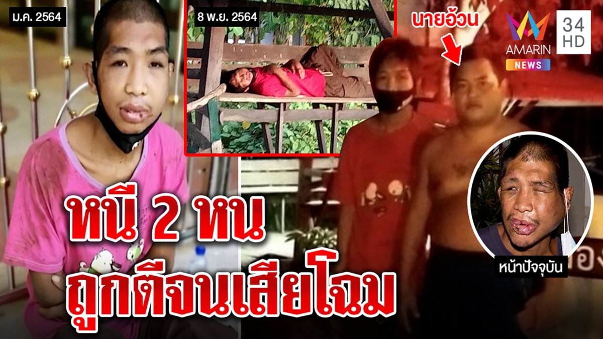 ช็อก! เผยภาพลับ "ฟ้า" หนีเจ๊กั้งหน 2 ถูกตีหน้าเสียโฉม คนพาเข้าขุมนรกคือไอ้อ้วน