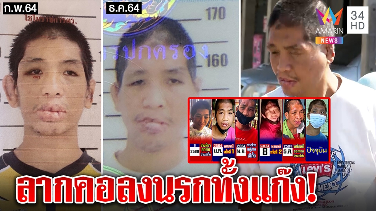แฉ "ฟ้า" ถูกตีหน้ายับหนุ่มจนโต เจอผัวเจ๊กั้งเอี่ยว ทนายดังจ่อลากคนรังแกลงนรก