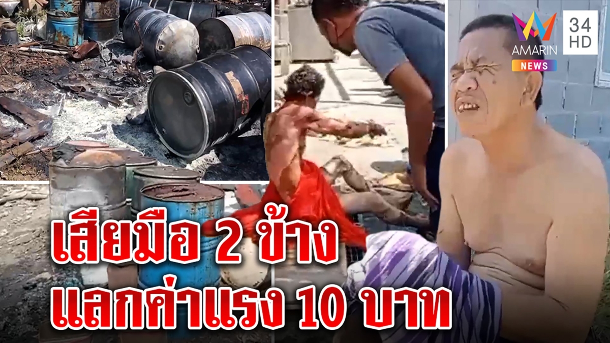 แกลลอนน้ำมันบึ้ม พี่น้องรับจ้างผ่าถังค่าจ้าง10บาทถูกไฟคลอกตัว-มือขาด หวิดดับคู่
