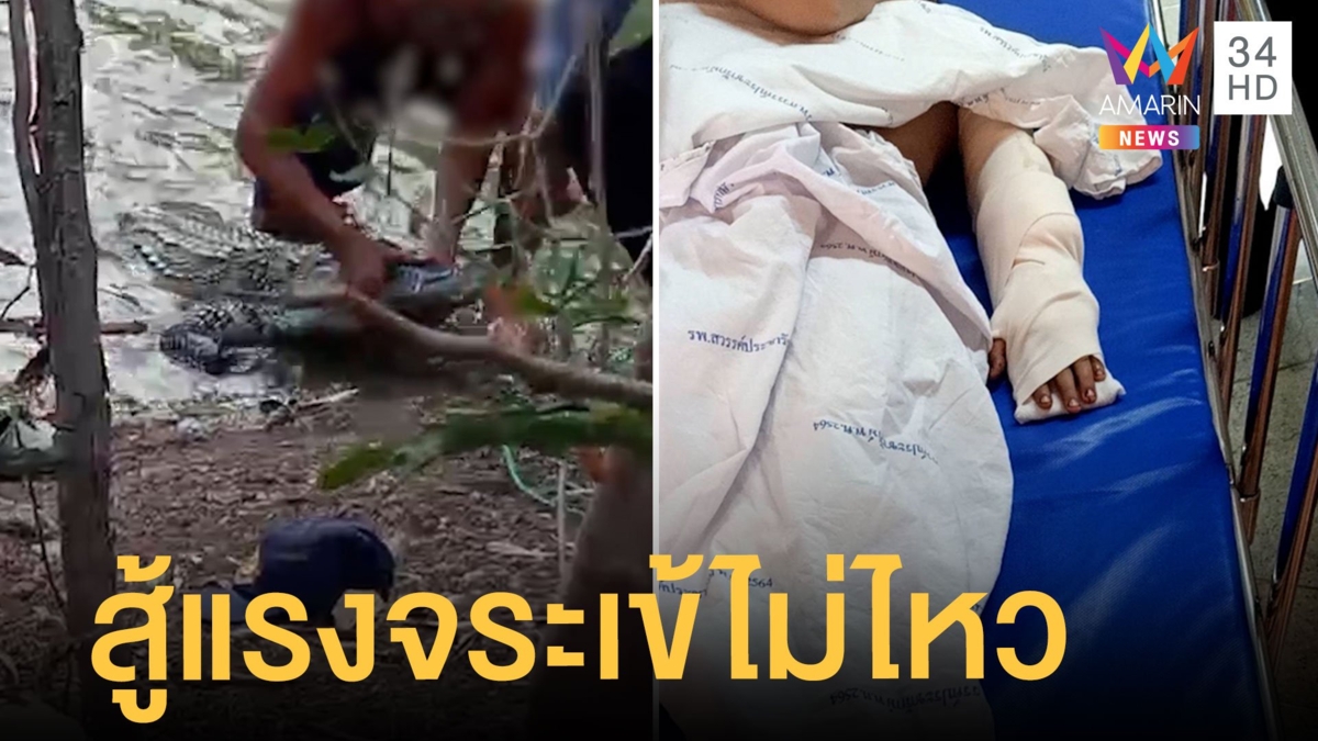 จระเข้กัดมือเด็ก 8 ขวบ กระดูกแตก ตอนนั่งหาไส้เดือน