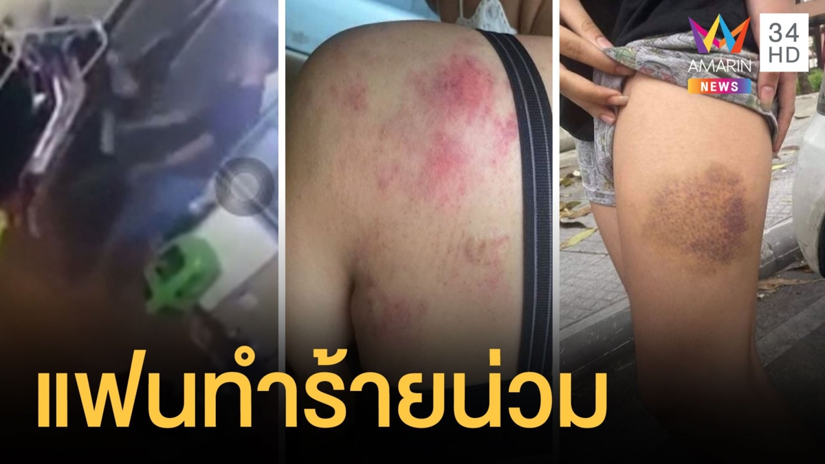นศ.สาวร้องถูกแฟนทำร้ายหัวฟาดพื้น มีดกรีดหน้าอก