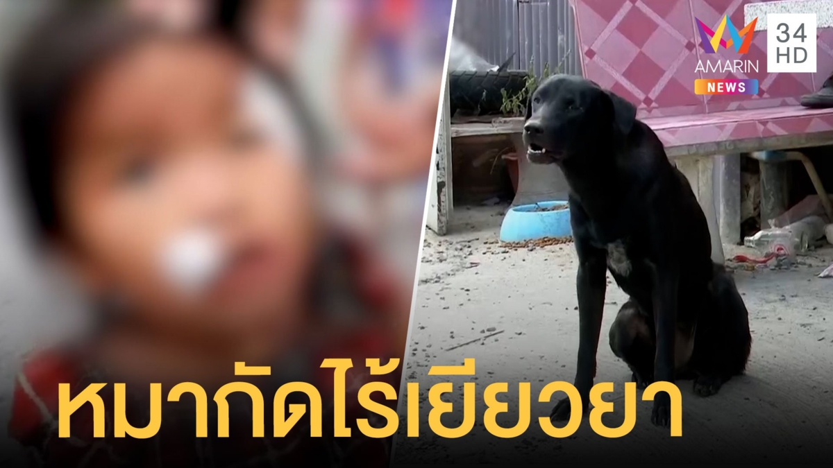 หมากัดเด็ก 2 ขวบหวิดตาบอด เจ้าของเมินรับผิดชอบ