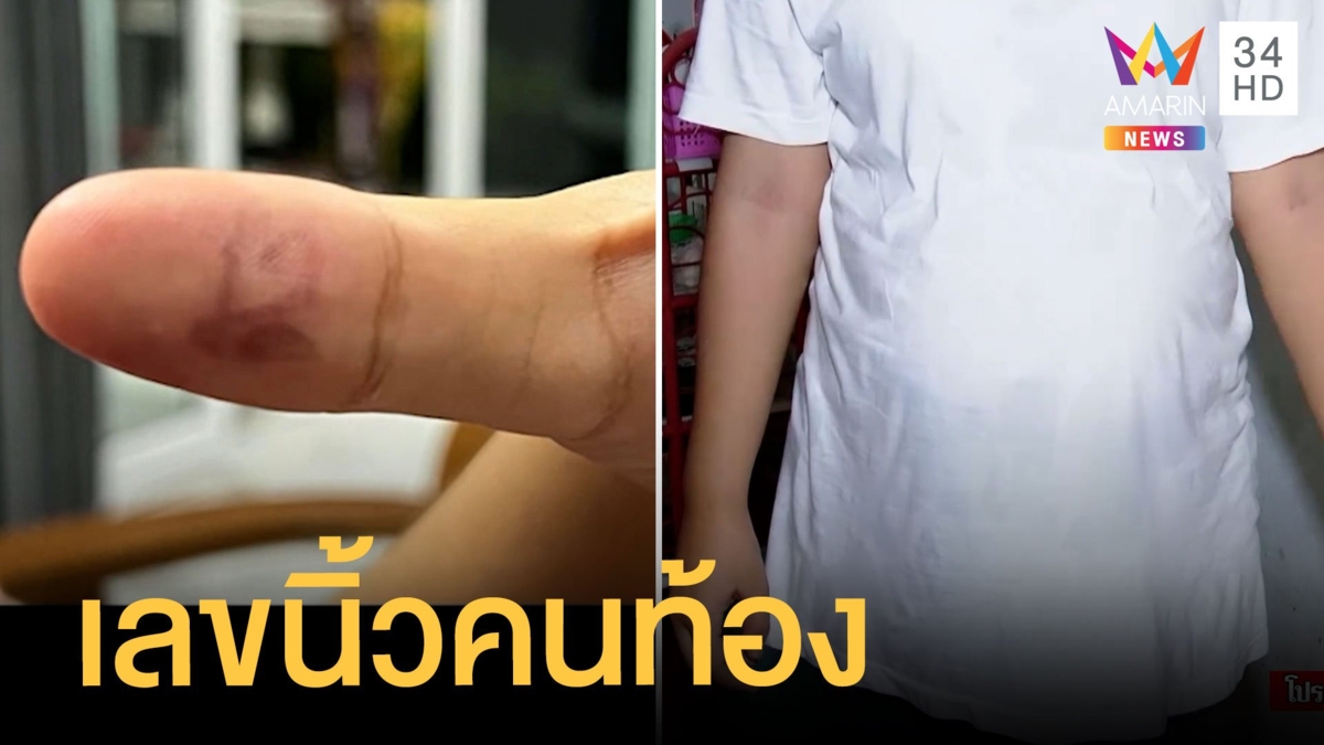 ถูกหวย 18 ล้าน เลขนิ้วคนท้อง สาวท้องแก่เล่าฝันเห็นพญานาคถูกหวย 4 วันติด