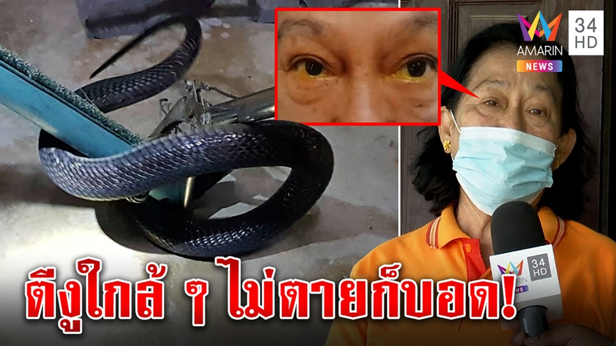 หวิดตาบอด! ป้าสู้งูเห่าโดนพิษเข้าตา ไขปริศนายืนห่าง 2 เมตร ทำไมเสี่ยงตาย