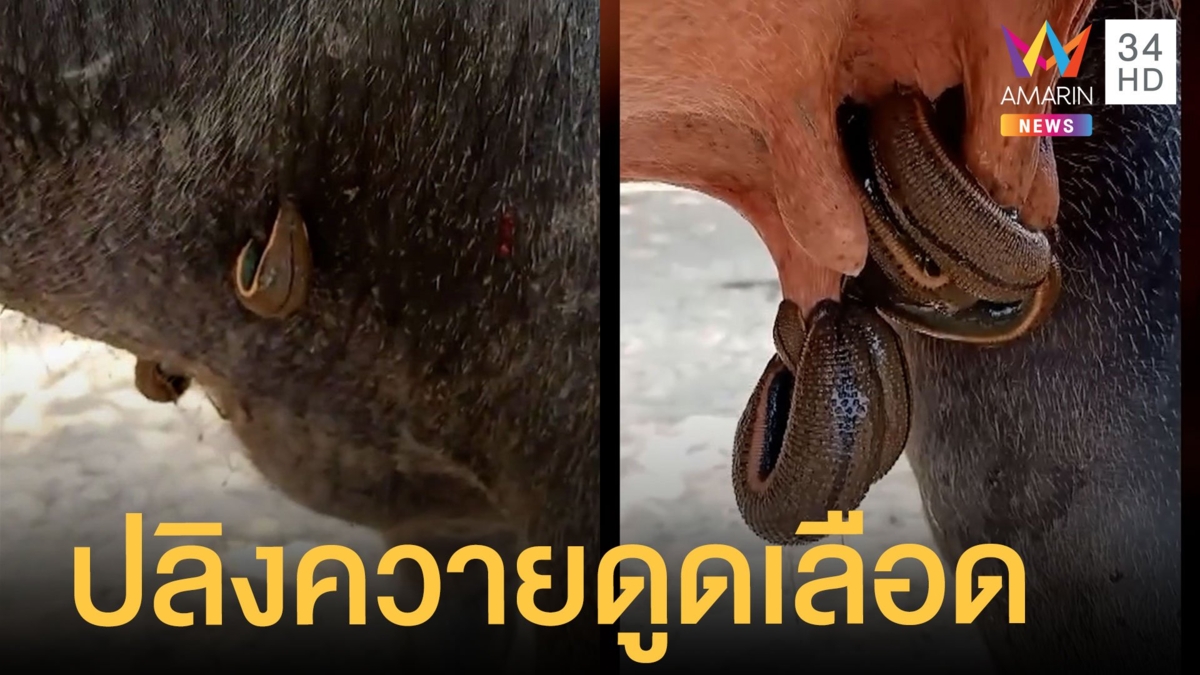 ปลิงควายเกาะเต้านมดูดเลือดเป็นสิบตัว