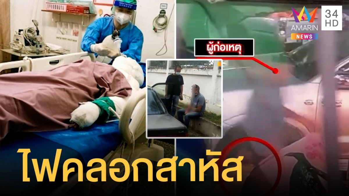 ล่าผัวโหด สาดน้ำมันใส่เมียจุดไฟเผา ไฟคลอกสาหัส
