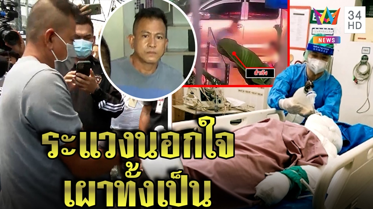 ผัวโหดราดน้ำมันเผาเมียโคม่าอ้างจับได้สนิทชายอื่น ชาวบ้านป้องคนเจ็บเชื่อไม่นอกใจ