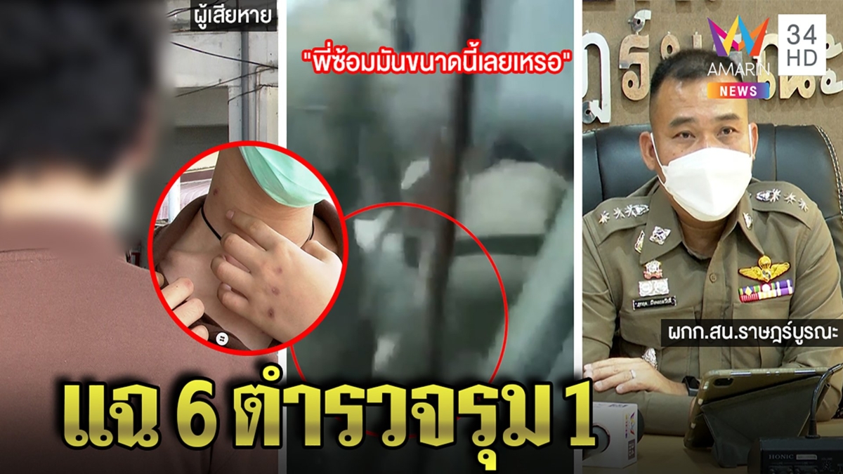 โจ๋แฉถูกตร.ซ้อมคาป้อมโชว์แผล6รุม1 ผกก.โต้โจ๋สู้ขัดขืนผิดรถแต่งซิ่งท้าฟ้องได้