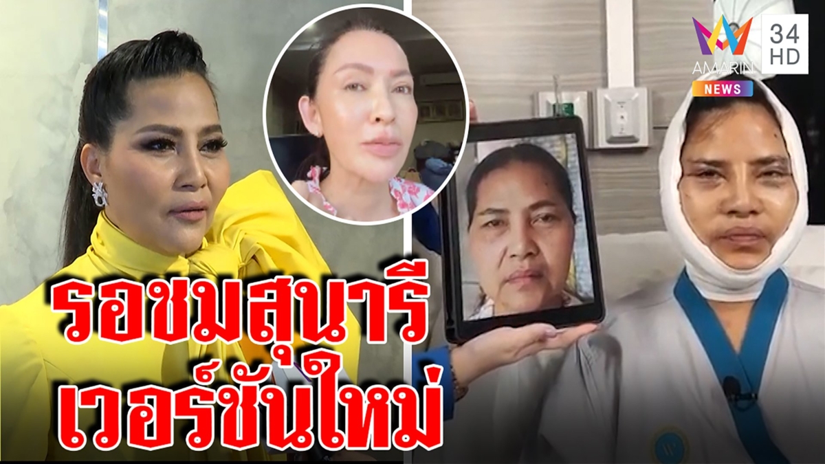"สุนารี"โชว์ครั้งแรกหลังศัลยกรรมดึงหน้า "ปุ้ย พิมลวรรณ"รับรองความปัง ยันสวยแน่