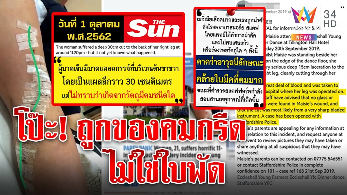 พลาด! แถลงแผลขาแตงโมเทียบตปท.ไม่ได้ถูกใบพัด อมรินทร์พิสูจน์เป็นน.ศ.ถูกของคมกรีด