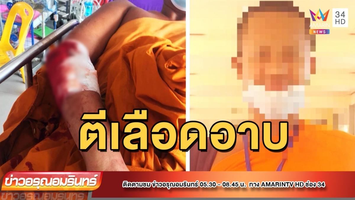 ญาติติดใจ สามเณรถูกเจ้าอาวาสทำร้าย คดีไม่คืบ