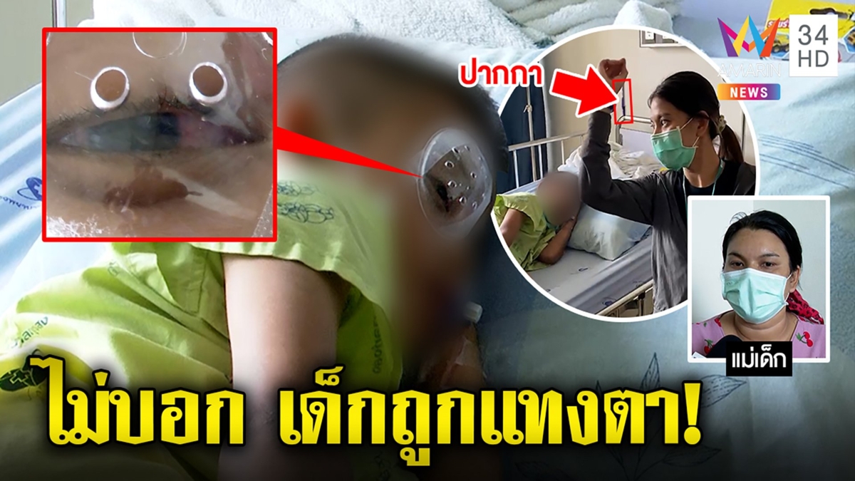 หนูน้อยถูกเพื่อนปาปากกาปักตา แม่งงครูปล่อยจนรักษาไม่ทัน รร.อ้างเด็กไม่บอก