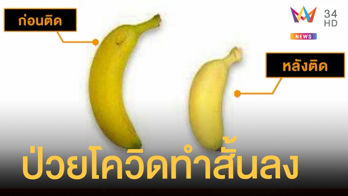 หนุ่มส่งข้อความถึงหมอแล็บแพนด้า ป่วยโควิดอวัยวะเพศสั้นลงเป็นนิ้ว