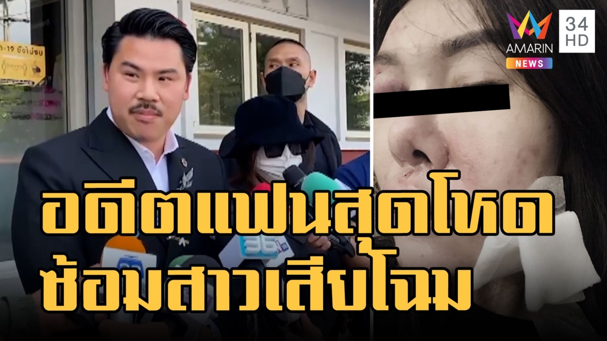 อดีตแฟนหนุ่มโหดกัด-ชกหน้าสาวน่วม หวิดเสียโฉม