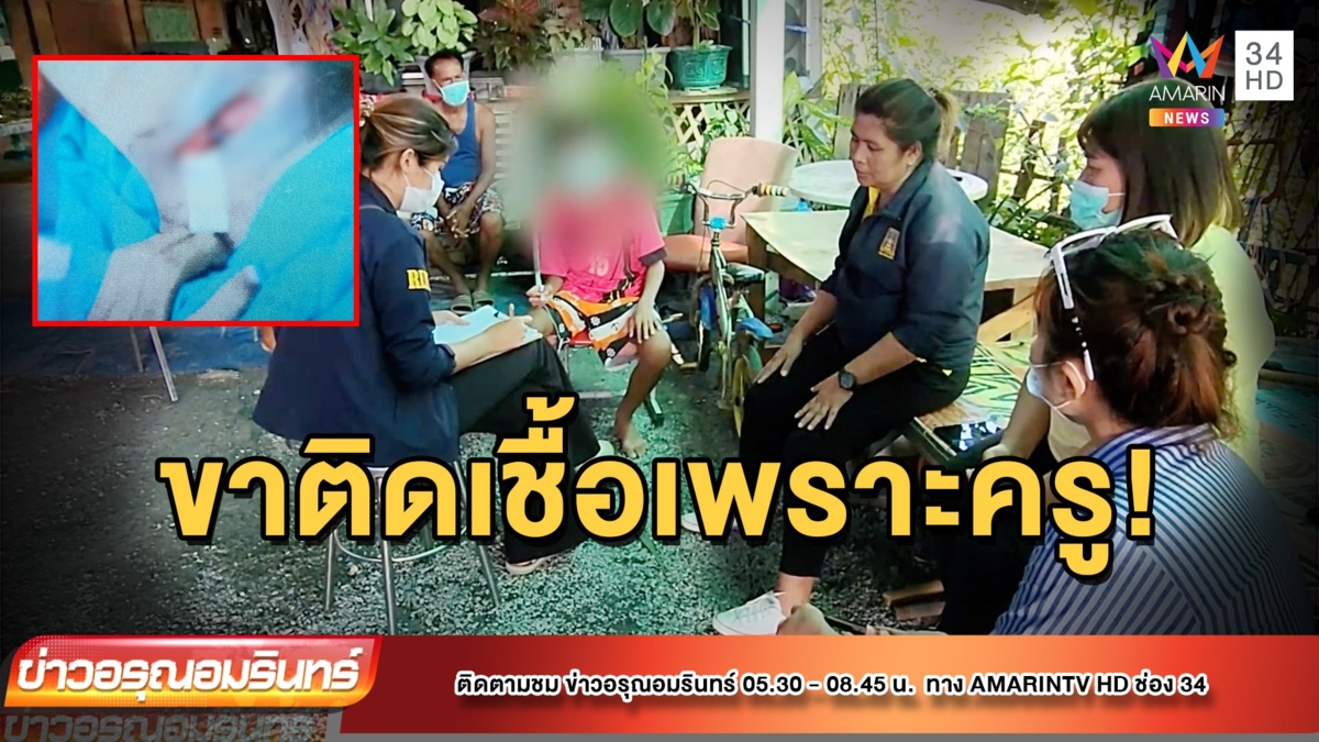 ครูโหด! สั่งทำโทษเด็ก ม.3 โดดเรียน ให้ลุกนั่ง 200 ครั้ง จนขาอักเสบติดเชื้อ