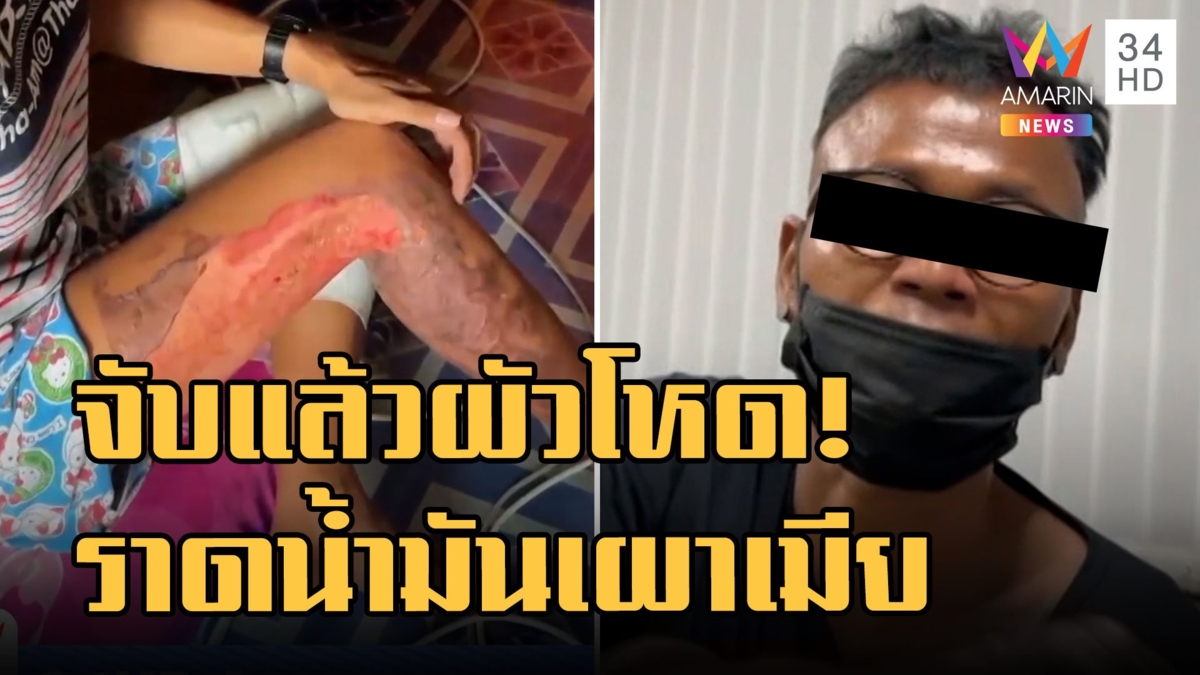 รวบแล้ว! ผัวโหดราดน้ำมันเผาเมีย