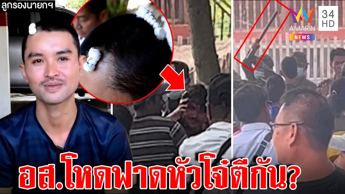 ลูกรองนายกฯ โวยอริตีงานกฐินซ้ำถูก อส.ฟาดหัวแบะ ถามแค่ชกกัน ทำไมต้องซ้อม