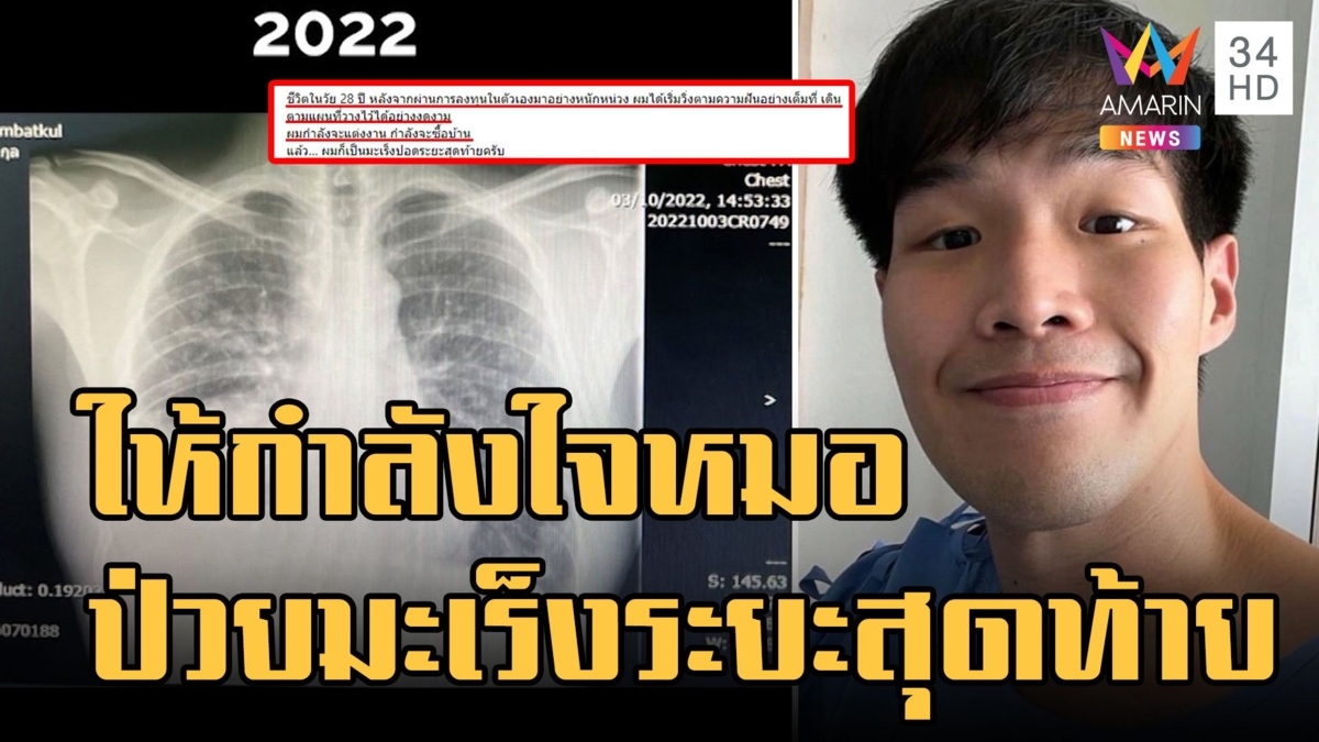 หมอหนุ่ม ป่วยโรคมะเร็งปอดระยะสุดท้าย