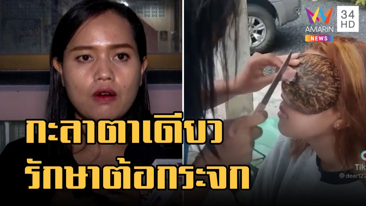 รักษาต้อกระจก ใช้กะลาตาเดียว แพทย์เตือนระวังติดเชื้อ