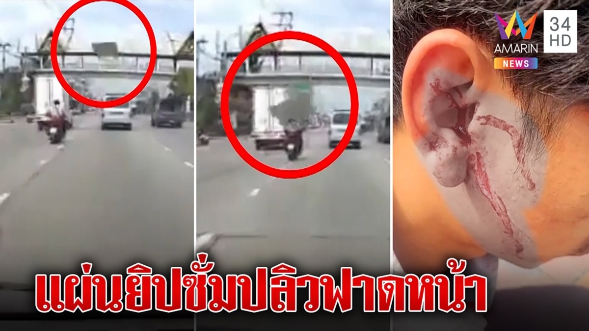 มอไซค์เจ็บ แผ่นยิปซั่มปลิวฟาดหน้าแตกกลางถนน เย็บ 24 เข็ม